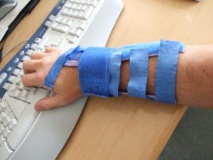 Splinted and wrapped lower arm with hand resting on keyboard.